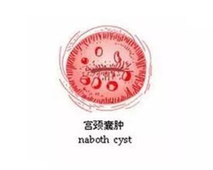 西安女子医院做妇科检查_天佑妇产医院怎么样_天佑妇产女子医院_西安女子医院_天佑妇产医院月经不调_天佑妇产医院无痛人流_小寨妇产医院